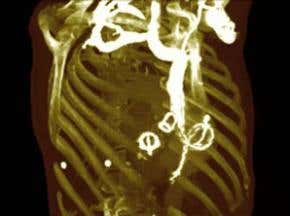 Nuclear plant shutdown brings hospital delays