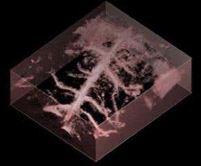 Laser scanner gives 3D view inside tumours