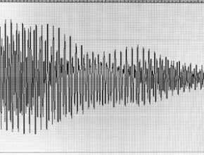 Brain 'seismology' helps predict epileptic attacks