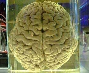 The strange anatomy of the brain