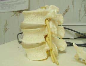 'Nerve bridge' bypasses spinal cord injury