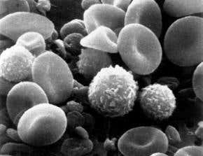 Stealth mutant HIV could hold key to vaccine