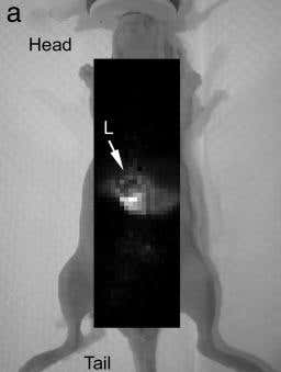 Laser medical scan does away with biopsies