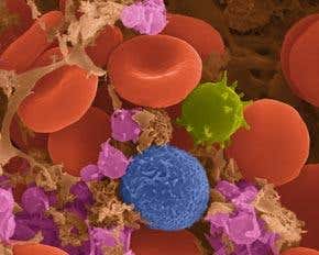 Reprogrammed immune cells could fight disease