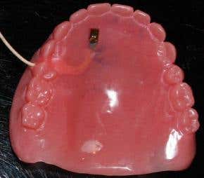 False-teeth sensors reveal tongue's twists