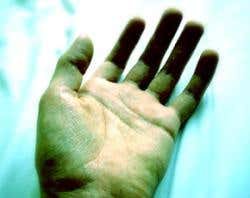 New Scientist. Science news and long reads from expert journalists, covering developments in science, technology, health and the environment on the website and the magazine.