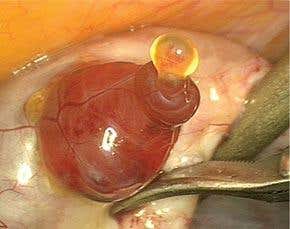 Human egg makes accidental debut on camera