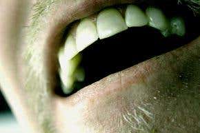 Brain implant helps stroke victim speak again