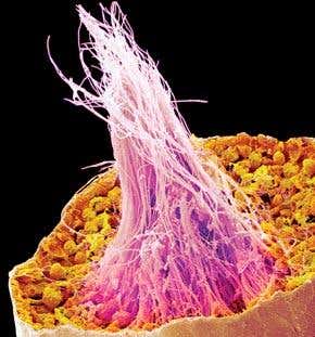 Youthful 'nurse' cells could restore male fertility