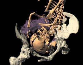 Did we out-breed slow-maturing Neanderthals?