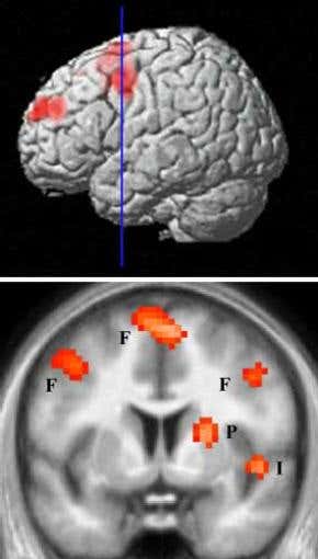 'Hate circuit' discovered in brain