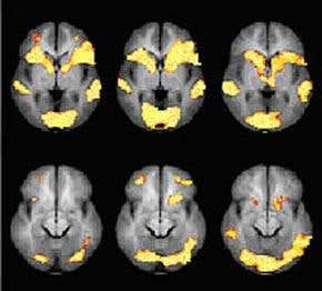 Could brain scans ever be safe evidence?