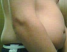 Growing waistline poses weighty risk to health