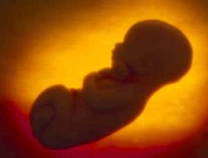 Safer fetal test for genetic diseases on horizon