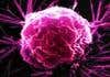 Implant raises cellular army to attack cancer