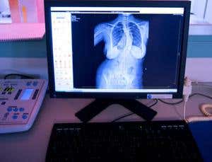 Liquid crystals could slash cost of X-rays