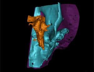 Bug-eyed fish reveals oldest fossil brain