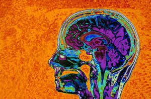 New Scientist. Science news and long reads from expert journalists, covering developments in science, technology, health and the environment on the website and the magazine.