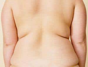 Mild obesity takes years off your life