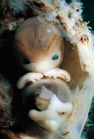 The five ages of the brain: Gestation