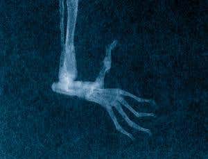 Close up showing the lack of grooming claw familiar with other lemur primates  