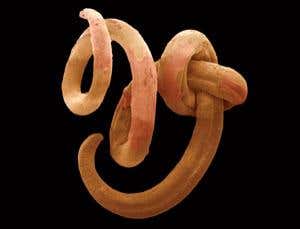 This nematode worm might look pretty simple, but it has all the key features of complex animals 