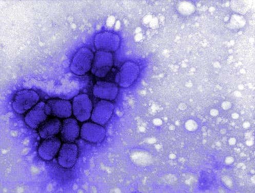 A transmission electron micrograph (TEM) of smallpox viruses