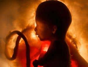 Premature babies' posture points to IQ