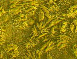 Close-up of the surface of a health microlung 