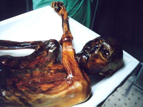 Ötzi during the sampling of the tattooed skin areas in the Archaeological Museum in Bozen, Italy.   