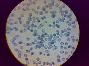 Could u txt me ur blood sample?