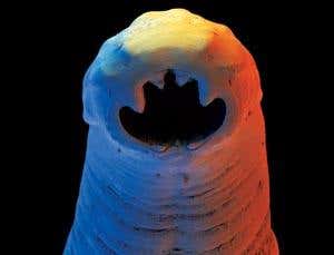 Parasitic worms: Just what the doctor ordered?