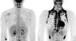 The fat that makes you thin