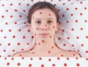 13 more things: Morgellons disease