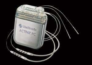 Smart implants may alleviate neurological conditions