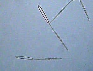 Here the needles have been triggered 