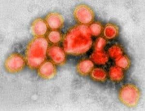 Swine flu myth: This virus won't get deadlier - that isn't in a germ's interests