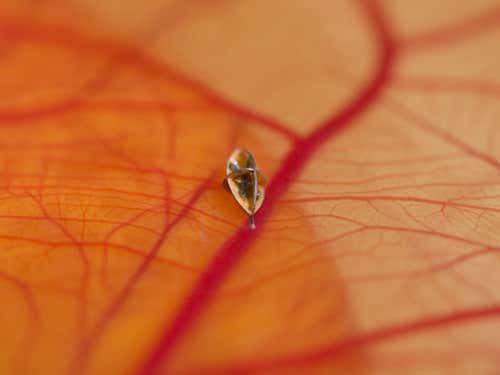 The ophthalmic robot seen here on a chick retina, is designed to treat blocked veins in the eye