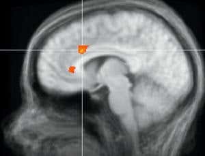 Brain scan reveals who will keep their promises
