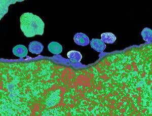 Fight HIV with HIV: 'safe' virus proposed as vaccine