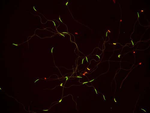 A microscopic picture with fluorescence-dyed sperm: green sperm is alive, red sperm is dead