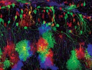 Picking our brains: Can we regenerate the brain?