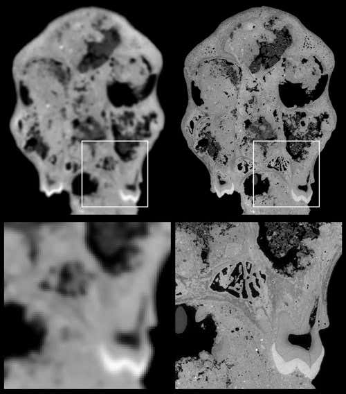 The tests compared a classical computer tomography scan (left) with a scan. Using synchrotron microtomography (right). The much higher resolution and contrast are clearly visible. The lower part depicts a zoom into an area indicated by the square. This area includes a tooth and a cavity in the skull.
