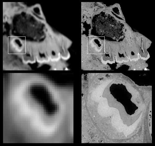 The image depicts a zoom into a tooth. In order to study the development of teeth, a resolution of between 10 and 100 times higher than on this image is needed.
