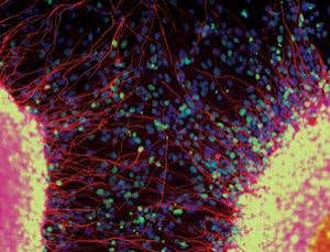 The secrets of intelligence lie within a single cell