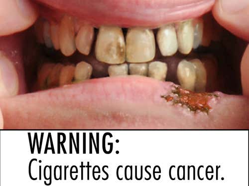 'Gross' disease images best at making smokers quit