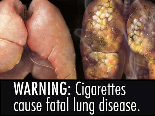 'Gross' disease images best at making smokers quit