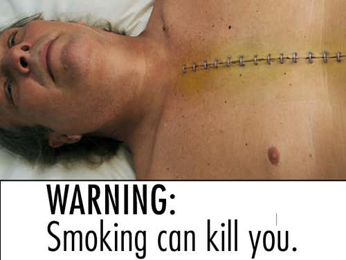 'Gross' disease images best at making smokers quit