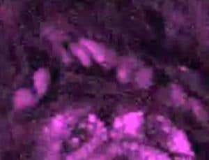 Videos of cells could replace cancer biopsies