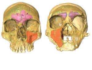Neanderthals' ugly faces weren't adaptations to cold